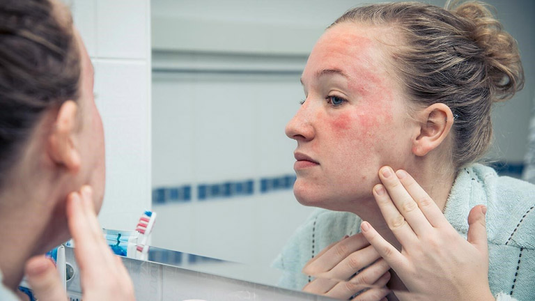 phương pháp trẻ hóa da mặt bằng laser - Bác sĩ Khải